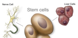 autologous stem cell treatment