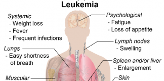 risk of leukemia