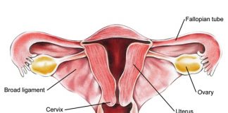 myths associated with ovarian cancer