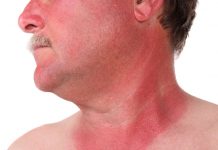 skin cancer myths busted