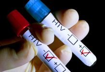 Link Between HIV and Cancer Examined by Study