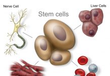 autologous stem cell treatment