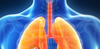 risk factors for small cell lung cancer
