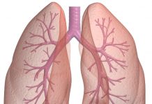 know about pleural effusion in lung cancer