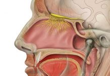 olfactory neuroblastoma symptoms and treatment